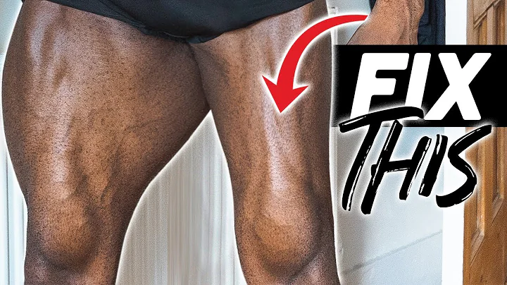 Do This To Fix Your Muscle Imbalance | 3 Easy Steps