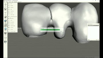 3 Shape Dental bridge design in MeshMixer, how to design the radius (0.90 mm) of gingival connector