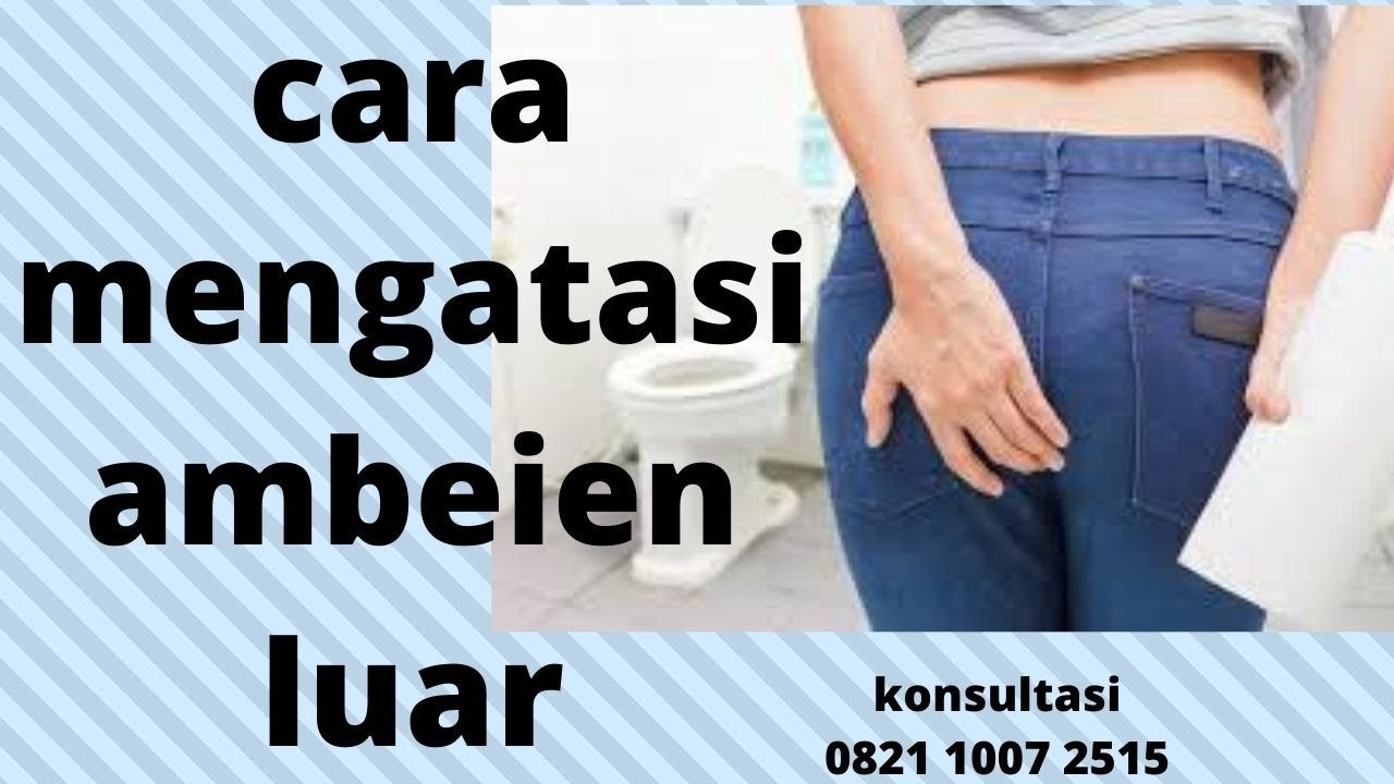 cara mengatasi ambeien luar