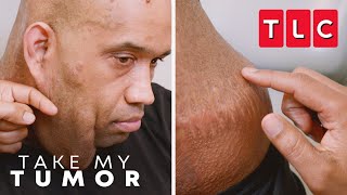 Marlow Considers a Risky Surgery | Take My Tumor | TLC