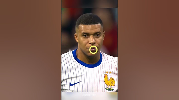 Funniest & Rarest Mbappé Moments Ever 😂 | You’ve Never Seen This Side! | WhistleXI