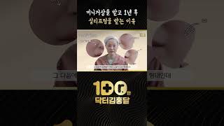 1년 전쯤에 미니 거상을 했는데 실리프팅을 받게 된 이유