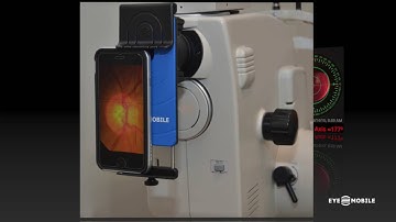 Eye2Mobile Eye Video and Picture Gallery  ...