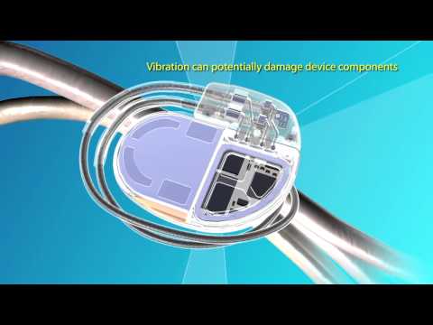 Medtronic Advisa™ DR MRI SureScan™ Pacemaker Video