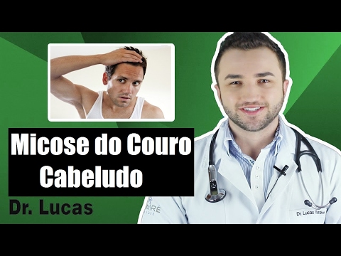 Vídeo: Micose Do Couro Cabeludo (tinea Capitis): Causas, Sintomas E Tratamento