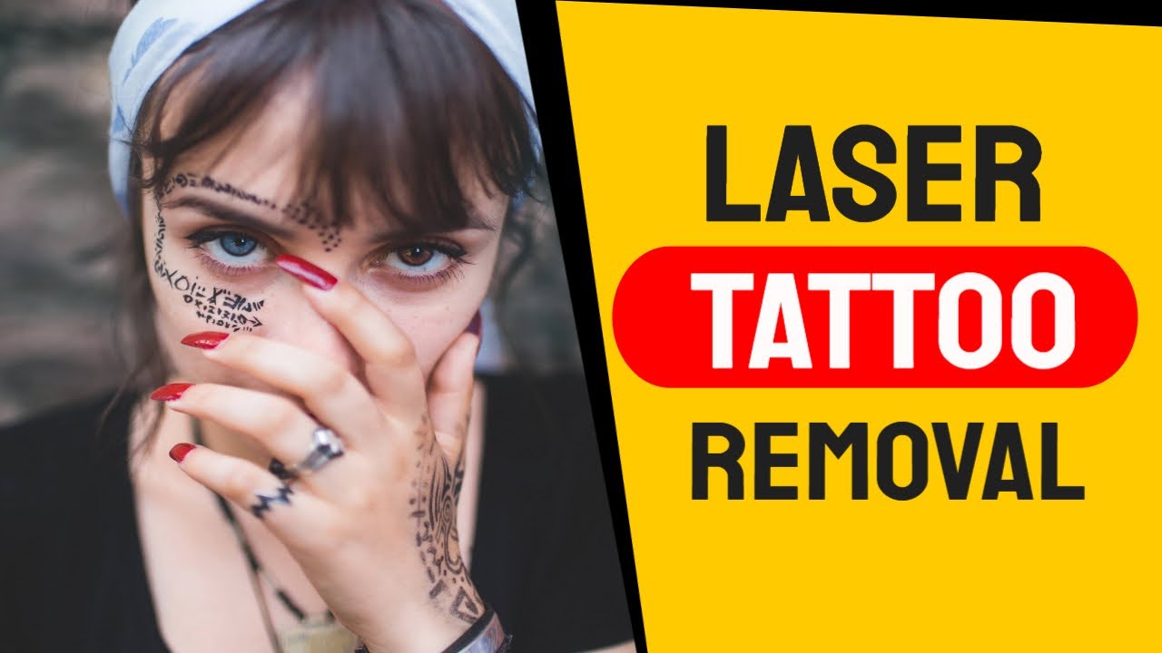 Laser Tattoo Removal Nottingham YouTube