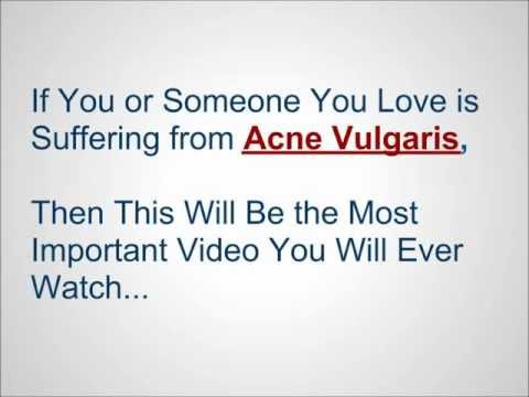Acne Vulgaris - get rid of acne vulgaris for good in next  days!
