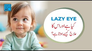 Lazy eye (Amblyopia) explained | Shifa News