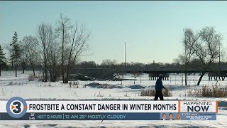 Frostbite a constant danger in winter months