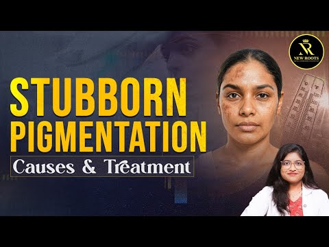 From Dull to Radiant: Complete Pigmentation Cure Explained! | New Roots