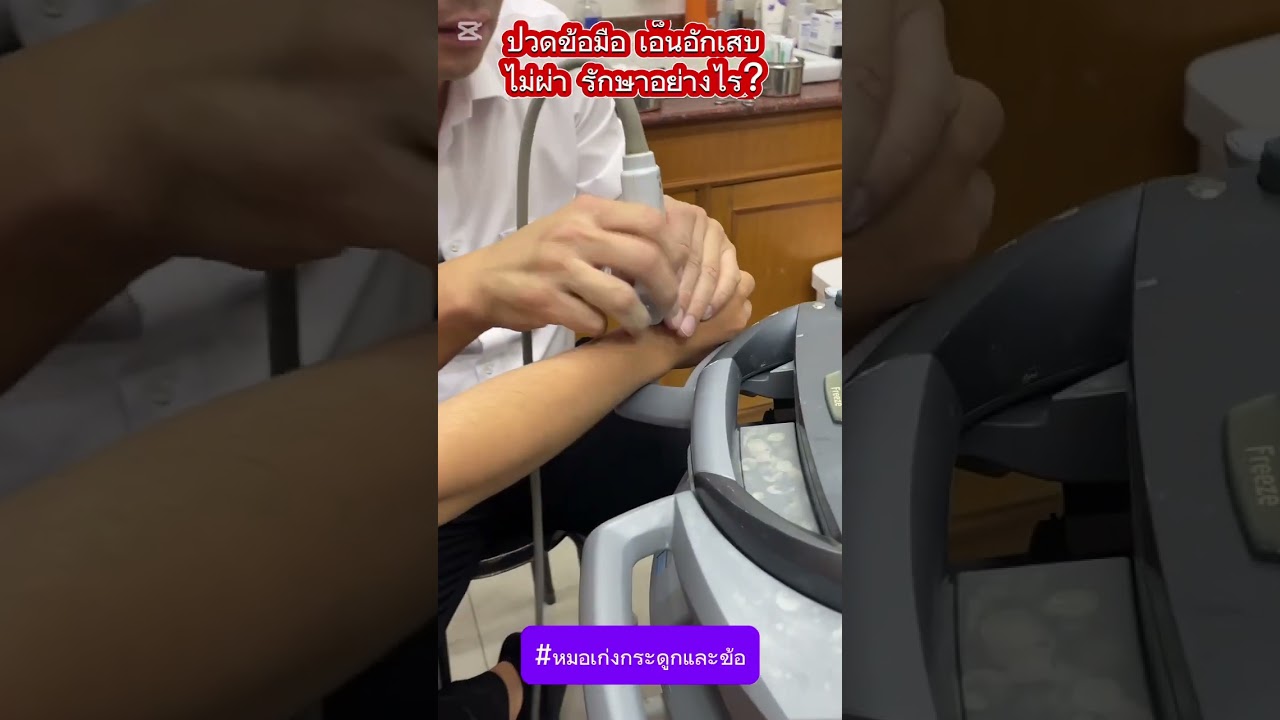 ข้อมือ เอ็นอักเสบ รักษาอย่างไร? De Quervain Ultrasound guided percutaneous release