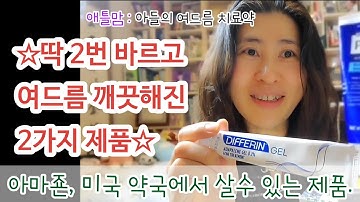 딱 2번 바르고 여드름 깨끗해진 2가지 제품 | 여드름 치료제 | 여드름 박멸 | 디페린겔, 벤조일 퍼옥사이드