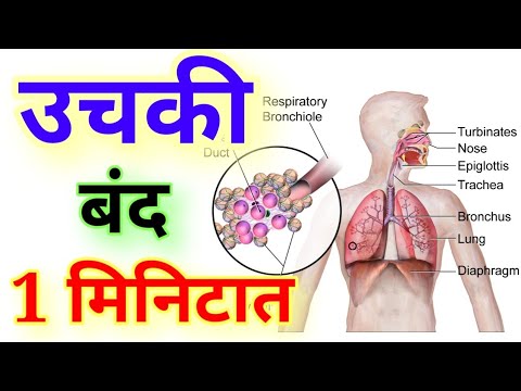 उचकी लागणे बंद करा फक्त 1 मिनिटात Hiccups home remedies in Marathi