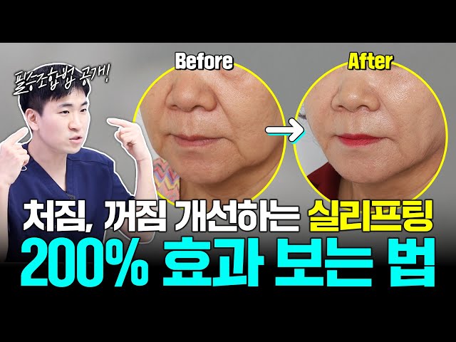 이렇게 하면 실리프팅 효율 2배!🫢 놓치면 손해입니다.