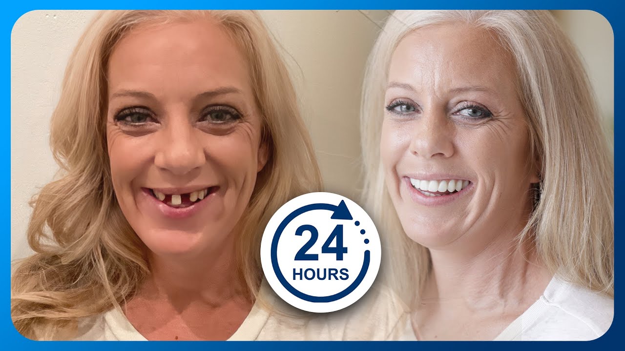 My dentist said "It WON'T work" I tried anyway