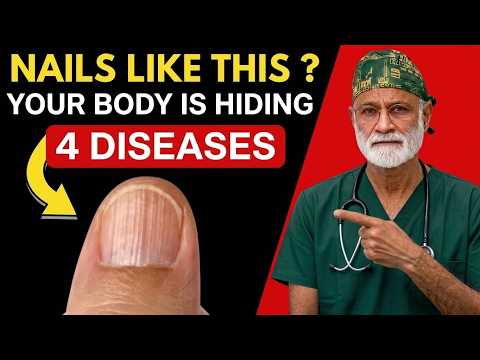 Neurologist Explains: If Your NAILS Look Like THIS After 60, Your Body Can be Hiding 4 Diseases.
