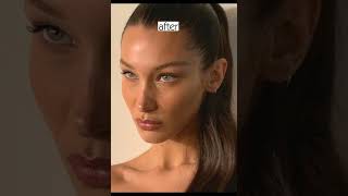 Celebrity Bella Hadid before and after plastic surgeries #shorts Net Worth