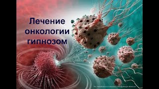 Лечение онкологии триггерным гипнозом