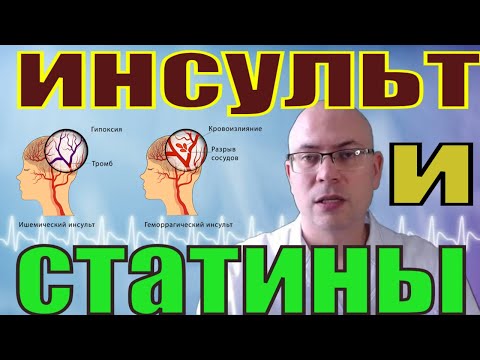 Статины: оценка риска инсульта инфаркта, уровни холестерина