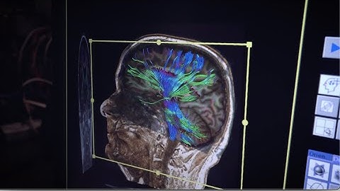 How BrainsCAN is making an impact on neuroscience