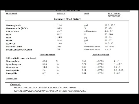 ازاي-تعرف-تقرأ-تحليل-الانيميا-(صورة-الدم-الكاملة-cbc)---بصورة-مبسطة---علوميات