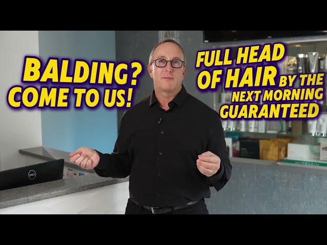 A Hair Transplant Won’t Give You a Full Head Overnight! | Nova Medical Hair Transplant