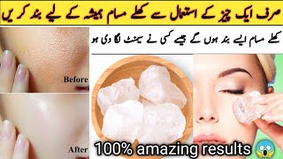 How To Get Rid Of Large Open Pores On Face- Khule masam band karne ka tarika |Open pores home remedy
