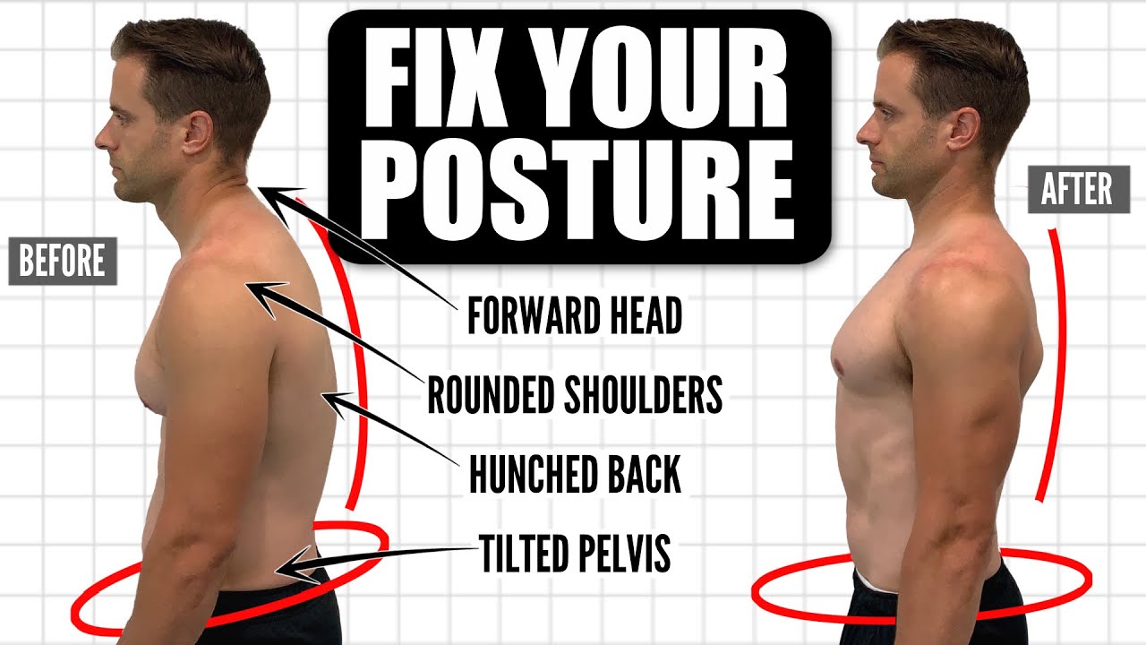 How To FIX Your Posture  10-Minute Daily Routine 