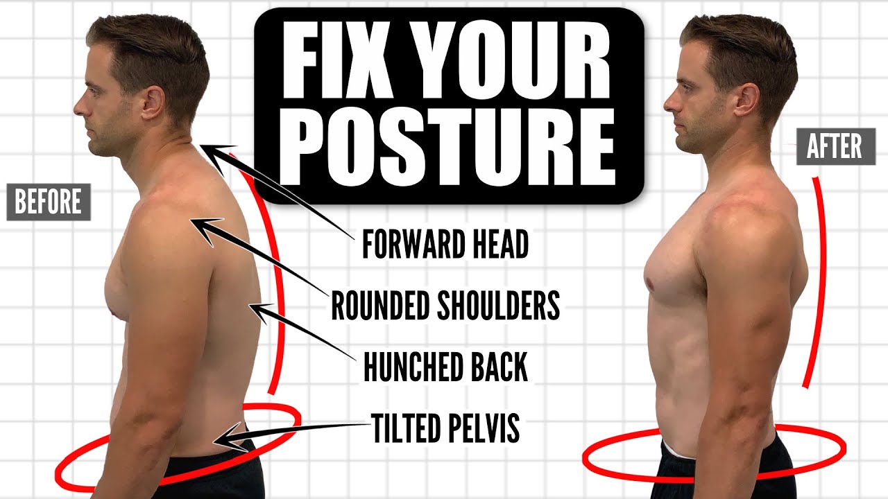 Fix Bad Posture & Relieve Back Pain with Straight 8 - Top Posture