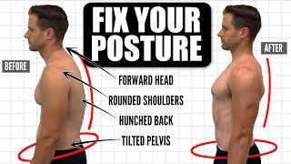 How To FIX Your Posture | 10Minute Daily Routine