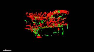 Human Molecular Genetics : The severity of retinal pathology in homozygous Crb1rd8/rd8 mice...