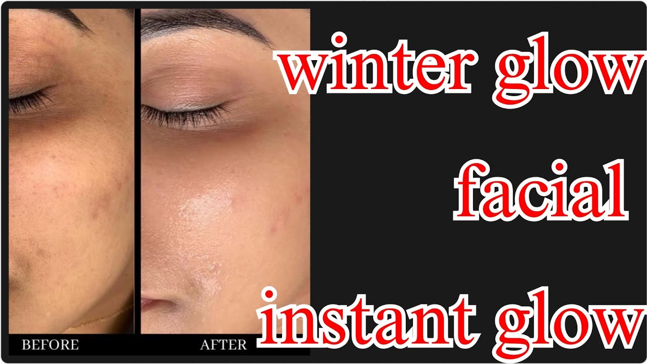 Urgent Winter Glow Facial for Dry & Dull Skin | Home Remedy❤️