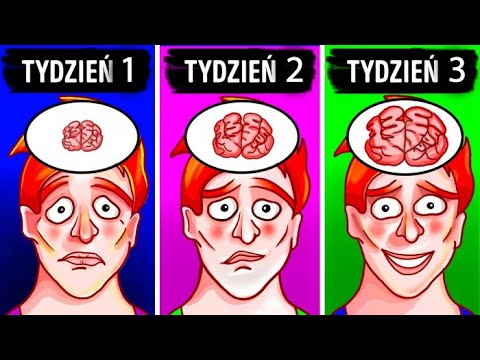 Wideo: Gry Neurologiczne Czy Mózg Jako Joystick - Alternatywny Widok