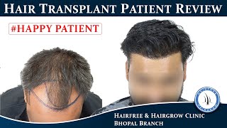 Hair Transplant Clinic In Bhopal || Happy Hair Transplant Patient -Best Result  Hairfree & Hairgrow
