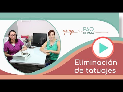 ¿Se puede retirar un tatuaje permanente?