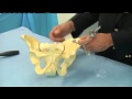 Orthopaedic trauma institute  pelvic trauma treatment advances