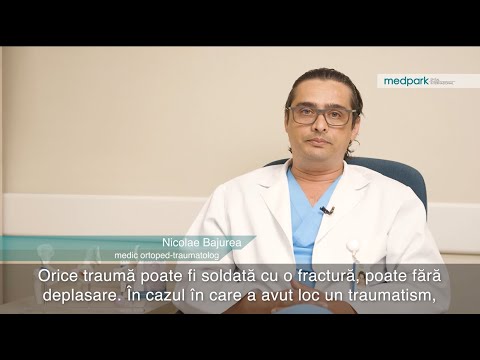 Video: Fracturi - Tratamentul Fracturilor Cu Remedii Populare și Metode De Medicină Tradițională