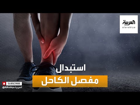 صباح العربية | متى نحتاج استبدال مفصل الكاحل ؟