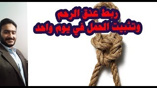 ربط عنق الرحم وتثبيت الحمل في يوم واحد