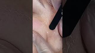 Anti - Aging Baķımlarla Hyaluronıc Asid Ve Collagen Mucizesi