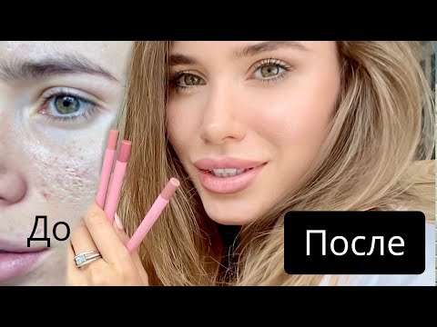 ПОШАГОВЫЙ МАКИЯЖ ДЛЯ НАЧИНАЮЩИХ | КАК Я СКРЫВАЮ ПОРЫ И РУБЦЫ | Любимые Помады и Карандаши