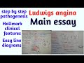 Ludwigs angina