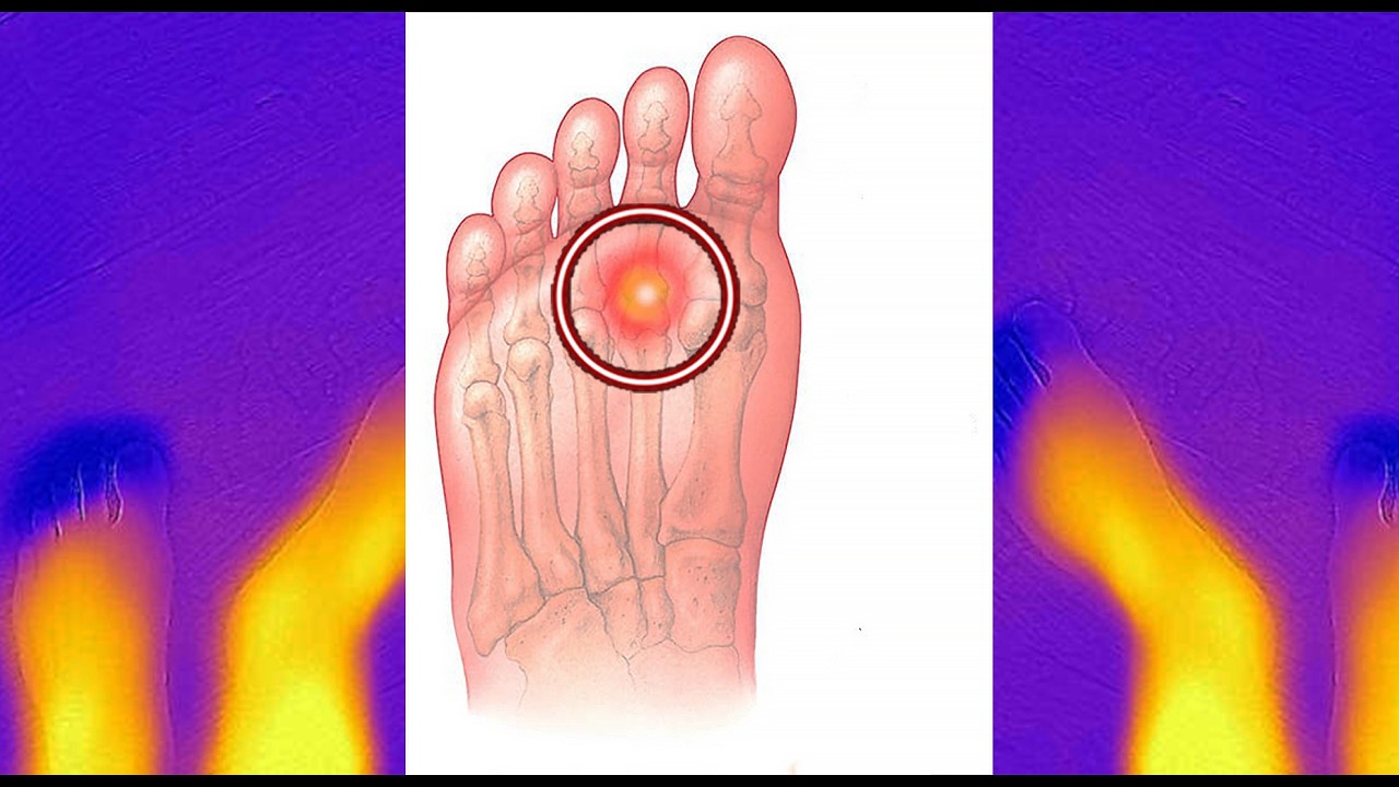 Ibimenyetso uzibonaho ku birenge| n'Indwara bisobanura| Ibirenge byoroshye| Ibirenge byiza bigezweho