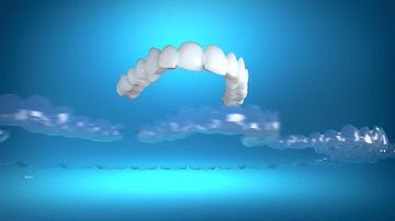 Invisalign® with Smile Design Dentistry