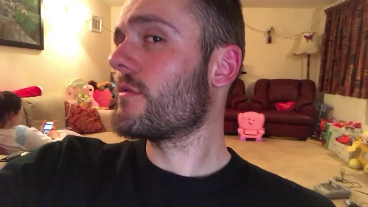 Week 13 Beard Minoxidil - Growth 