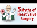 Patient webinar the 5 myths of heart valve surgery webinar with dr marc gerdisch