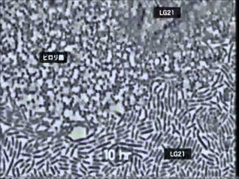 ピロリ菌の感染者がlg21ヨーグルトを食べたら Youtube