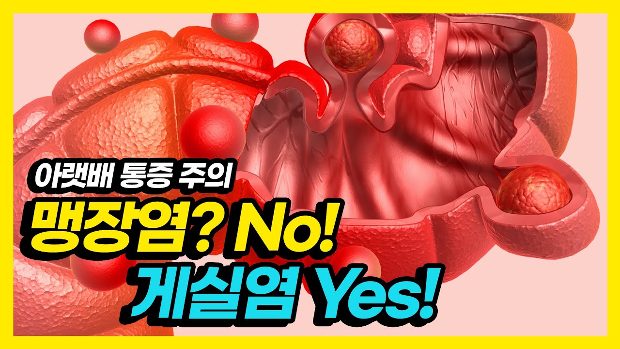 맹장염인줄 알고 병원을 찾았더니, 게실염 이라고?