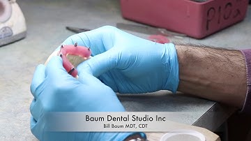 Implant verification jig pt1