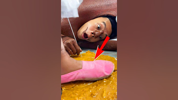 ToRung comedy: 😂 lost the squid game 🦑